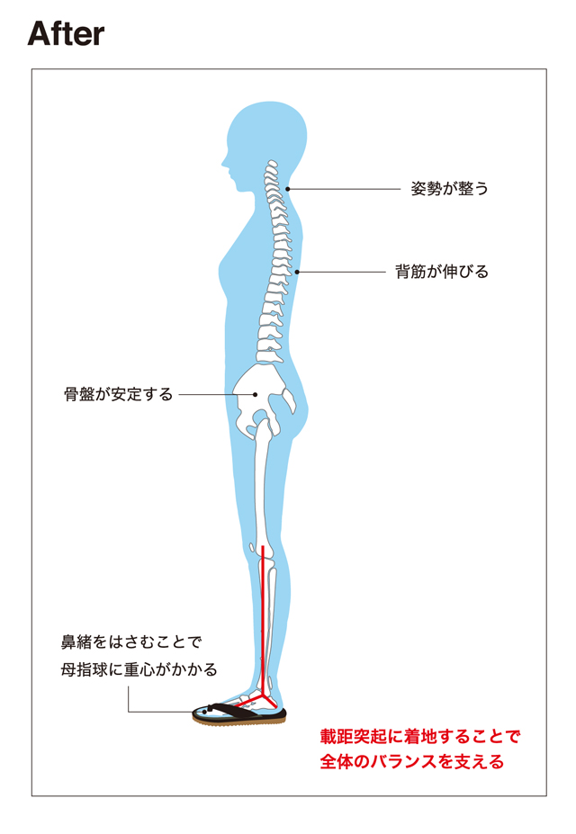 IXAZを仕様した際の骨格イメージ